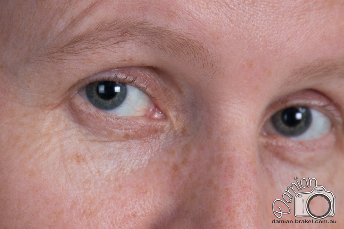 IMAGE: http://brakel.com.au/other/8-2.jpg